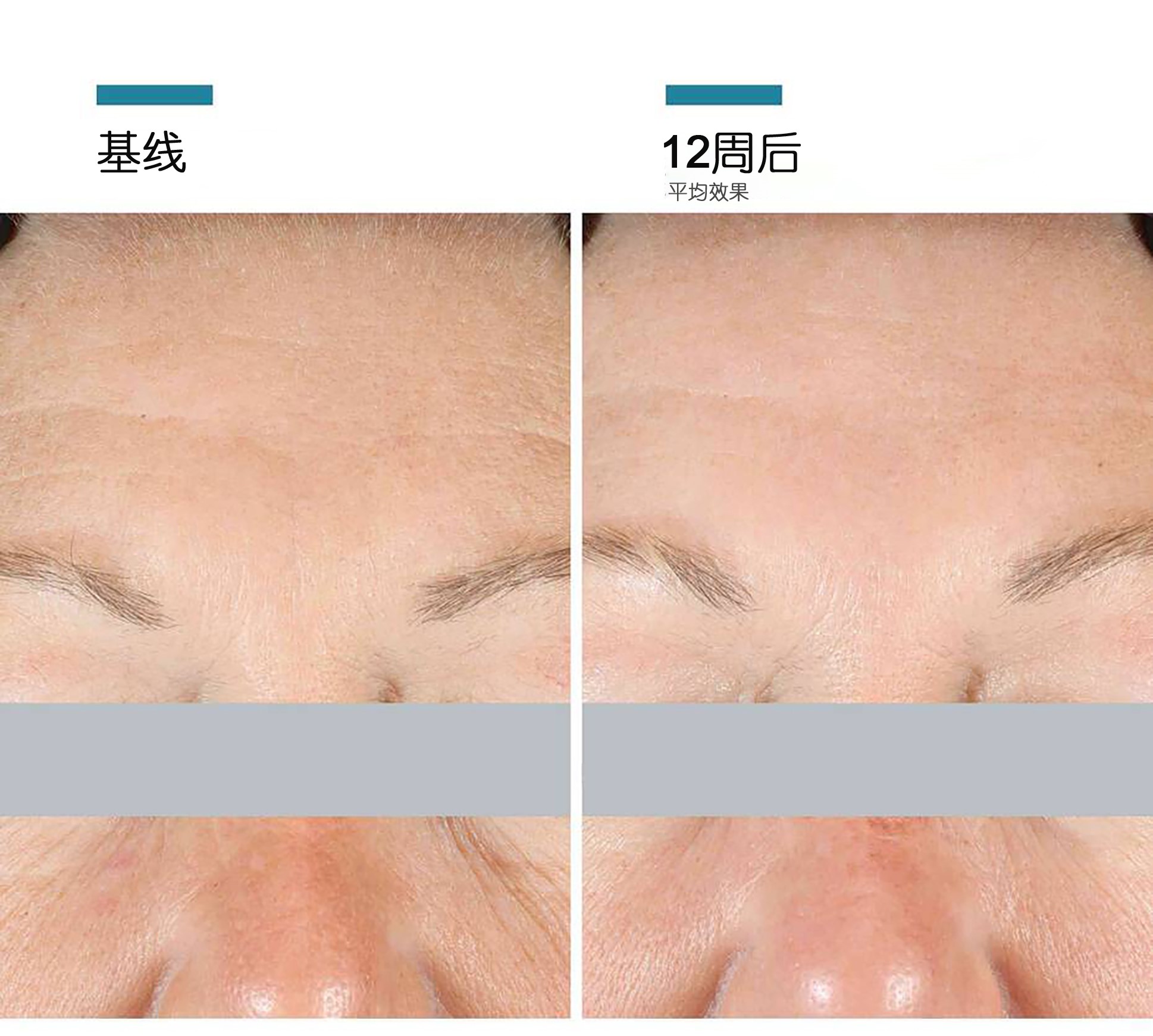 【香港直郵】美國 SKINCEUTICALS 修麗可 AGE乳霜15ml×3支 杜克緊緻塑顏精華霜 45ml 30%玻色因 抗糖化抗老 淡化細紋