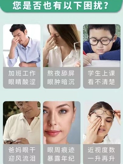 Ricoh Baicao Shurun crema para el cuidado de los ojos, esencia de leche, tienda insignia oficial genuina para el cuidado de los ojos, alivia la visión y la fatiga ocular