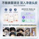 Мужской шампунь для кожи головы на основе аминокислот, удаление перхоти, против зуда, контроль жирного блеска, придает объем