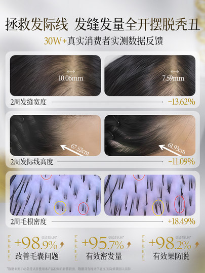 生姜洗发水防脱固发控油蓬松去屑止痒增密育毛膏露男女品牌旗舰店