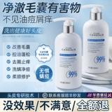 Мужской шампунь для кожи головы на основе аминокислот, удаление перхоти, против зуда, контроль жирного блеска, придает объем