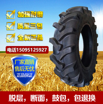 Tractor herringbone fetal 8 3 9 5 11 2 12 4 13 6 14 9 16 9-20 16 24-28