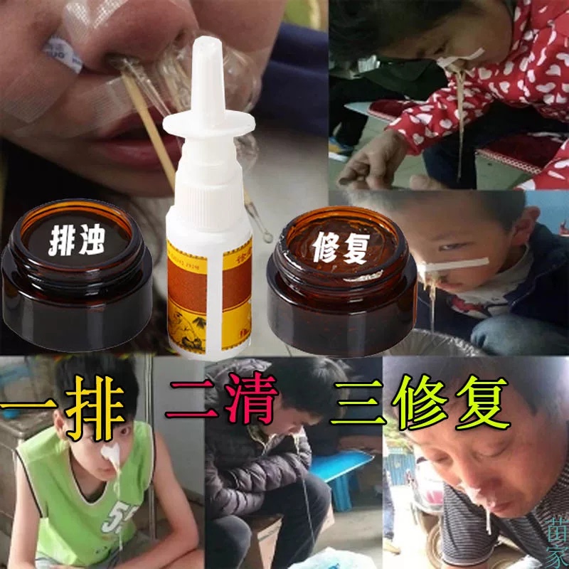Miaojia Goosegrass Nasal Ointment for Allergic Sinusitis, Nasal Congestion, and Runny Nose - Specialized Pure Chinese Medicine