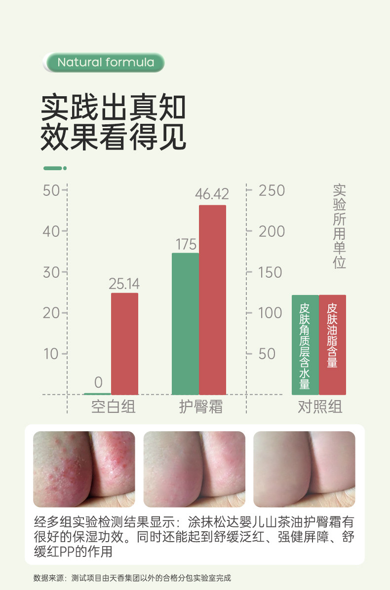 松达 山茶油 婴儿护臀膏 21g 天猫优惠券折后￥29包邮（￥49-20）