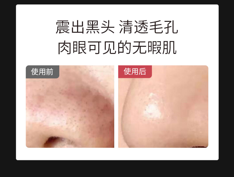 日本 可思美 CosBeauty 超声波美容仪 铲皮塑V脸吸黑头 图6