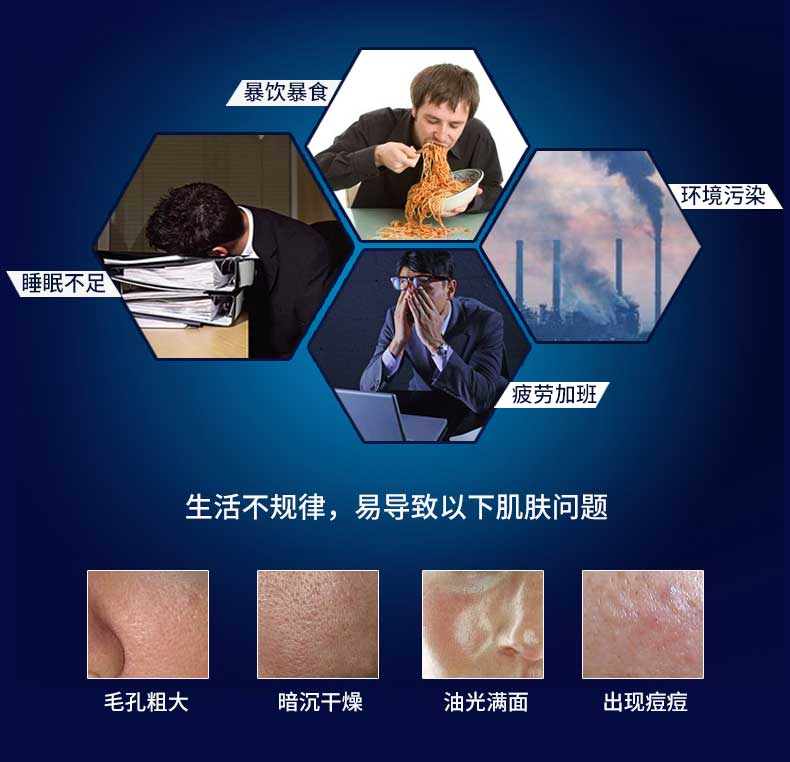Nivea của Nam Giới Bộ Chăm Sóc Da Giữ Ẩm Mặt Sữa Rửa Mặt Cảm Ứng Dầu Mặt Kiểm Soát Dầu Kem Chăm Sóc Da Mặt kem dưỡng trắng da mặt cho nam