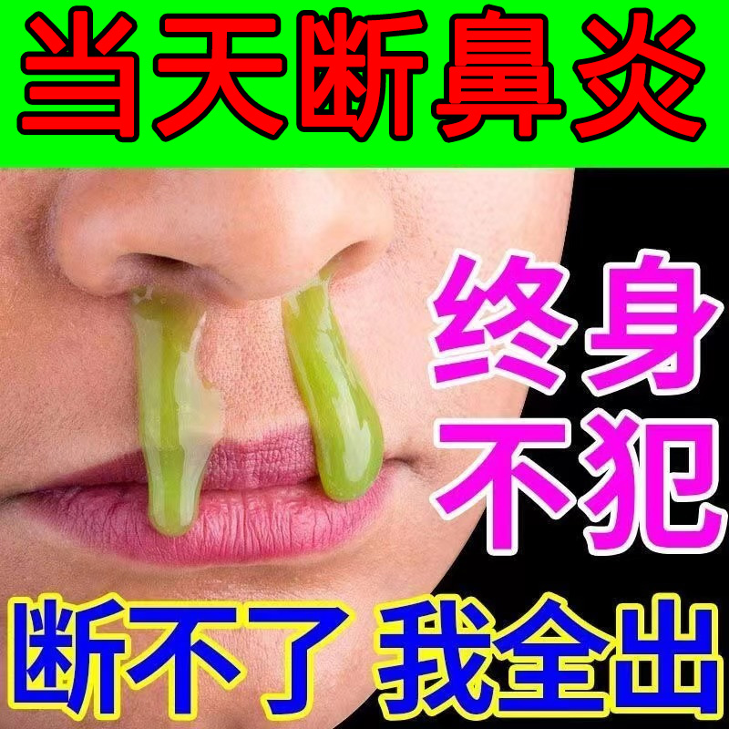 Goose Non-food Grass Cure Rhinitis Cure root rhinitis paste Miao home Goose Rhinitis Tablets Rhinoplasaceae Specialties Medication Radical