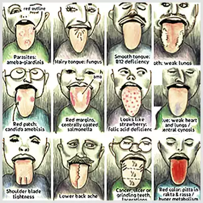 To fill the post of SF postage please wu luan pai