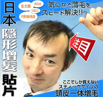 Japan quick pon invisible dense hair fiber patch forehead false hairline High Shift M-type plaque bald