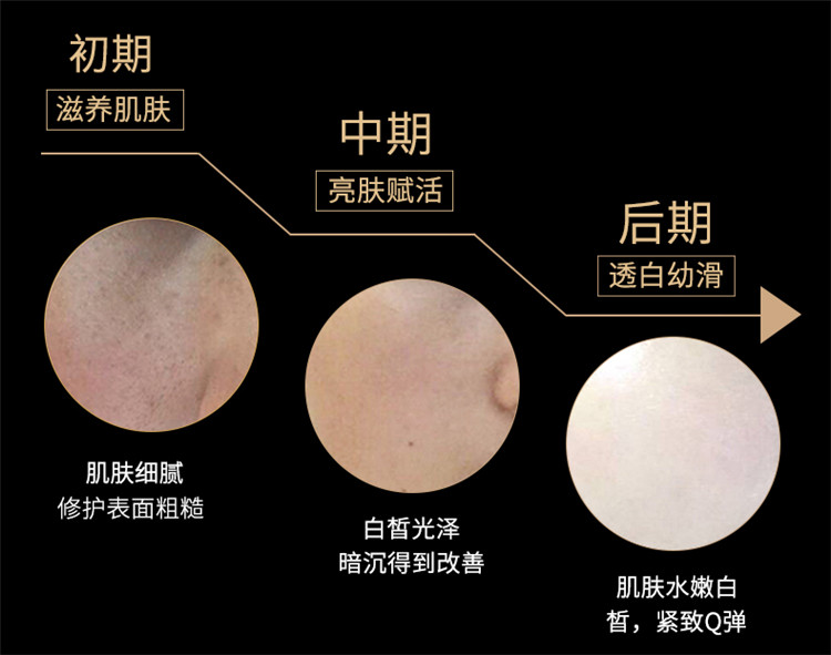 Giấc mơ thơ Li Tian Qiong Zhen Yu Yan kem đích thực là kem mặt lười biếng để trị mụn. kem dưỡng ẩm b5