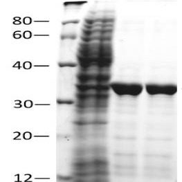 GST-tagged Protein Purification GST标签融合蛋白纯化试剂盒