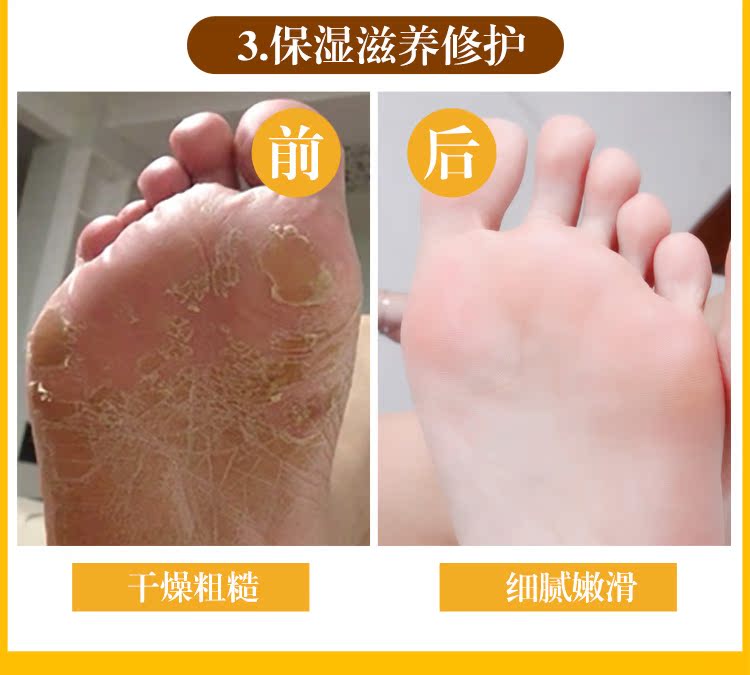 Sáo tình yêu chăm sóc chân gói phim chân sáp để loại bỏ da chết Ông già lột mặt nạ chân để tẩy tế bào chết cho bàn chân trắng kem trị nứt gót
