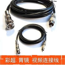 Gastroscope Color ultrasound Anorectoscope Otolaryngoscope Endoscope Image graphic system Video image cable