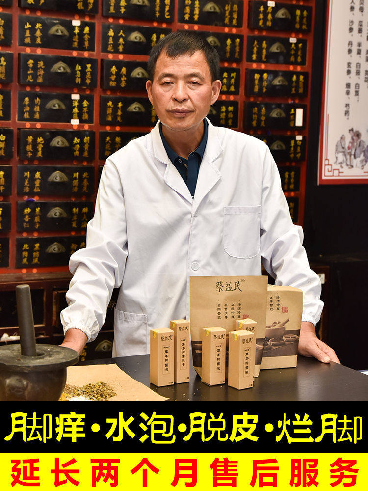 Direct to the root causes-foot itching peeling water and bad foot girl odor Cai Yimin zu Chuanliang Fang