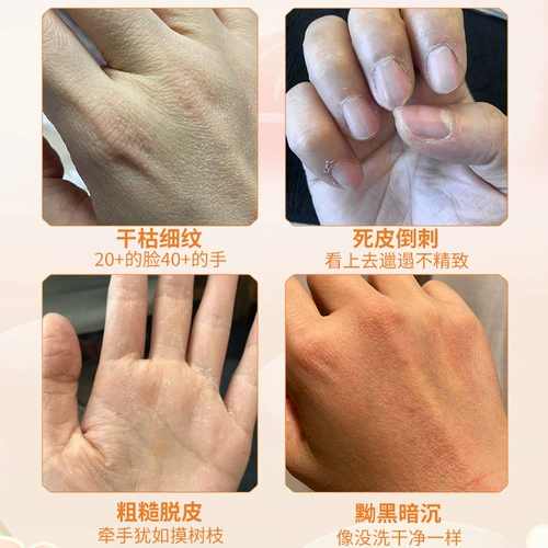 [Вернуть свои нежные руки] Рука бабушки становится рукой девушки, чтобы попрощаться с рукой приготовленной женщины, увлажняющей нежную белую и воду, купите 2 Get 1