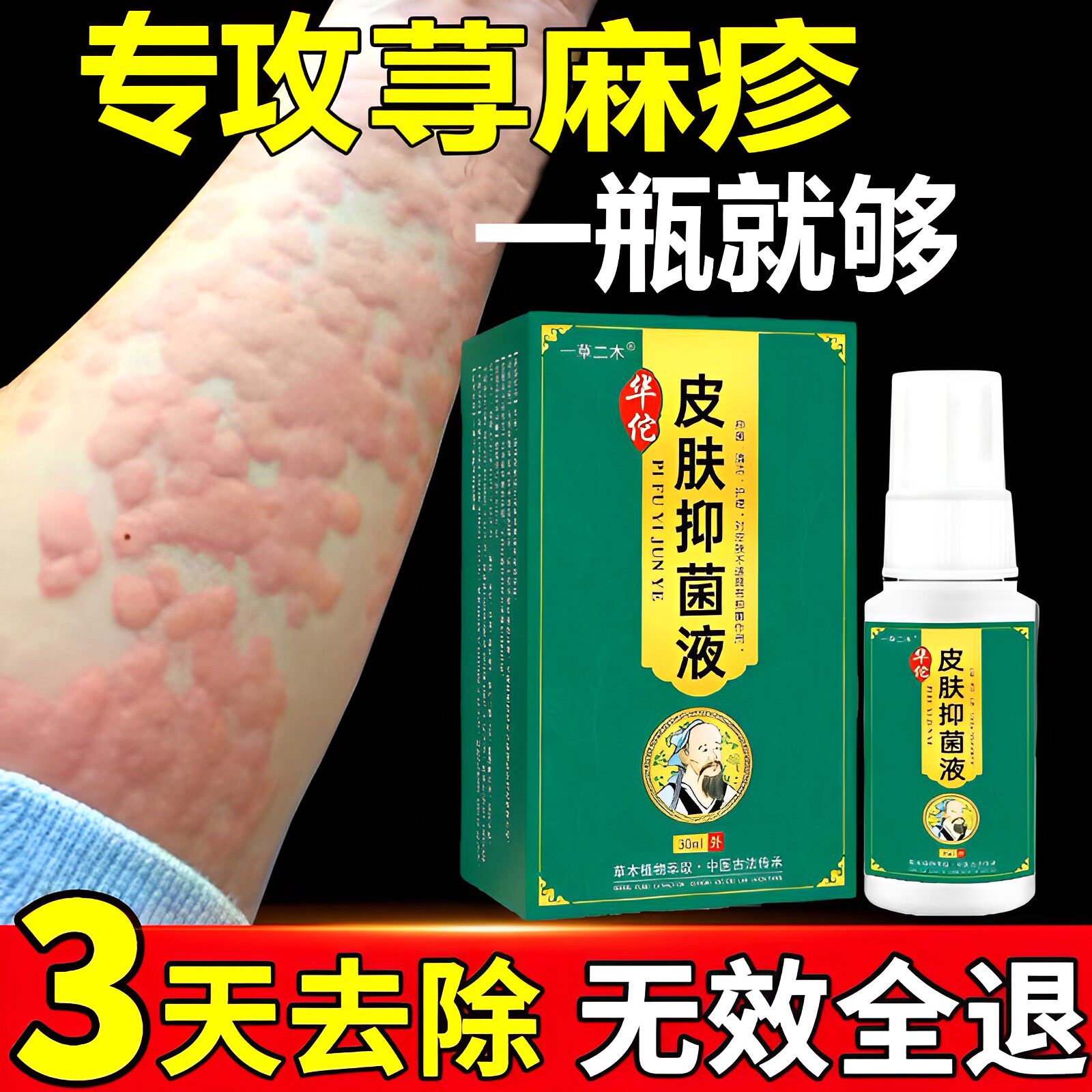 Seeking Urticaria Allergy Anti-Itch Spray Root Special Ointment To Treat Chronic Urticaria To Stop Itching Spray Root-Taobao