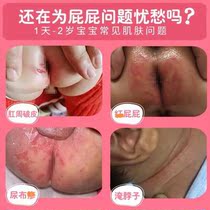  Red butt butt cream Baby rotten butt artifact Newborn baby wet flooded skin hormone-free camellia ointment
