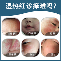  Wet itch cream Infant milk ringworm Baby saliva hot rash Baby treasure antibacterial anti-itch cream Childrens itchy skin