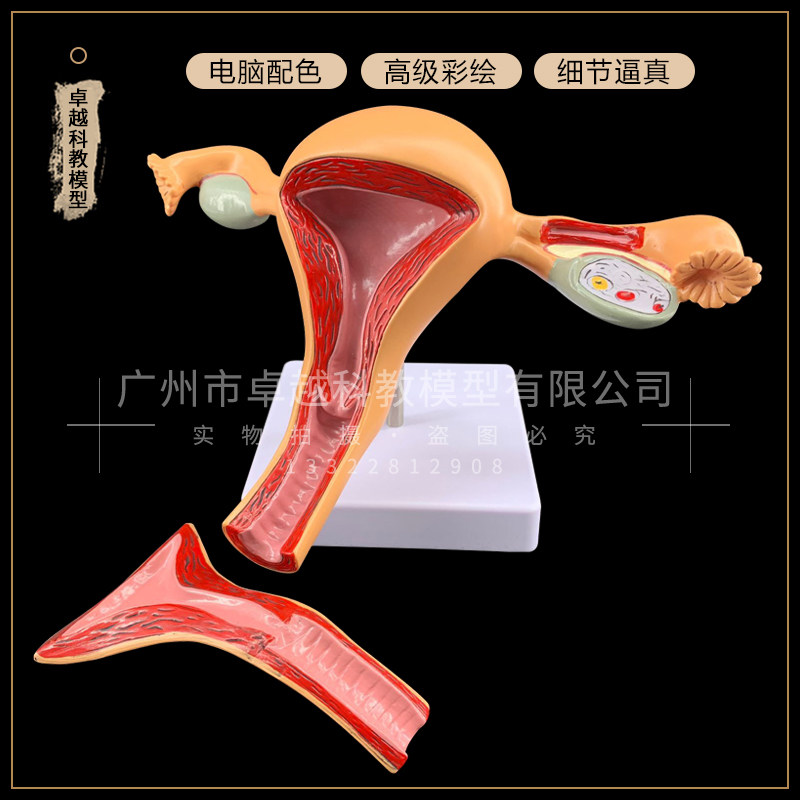 正常子宫模型、卵巢病理病变模型 生殖科 女性子宫阴道模型 包邮
