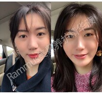 High nose essence liquid beautiful nose essential oil narrows small black bottle thin nose clip trembles with the same nose change artifact