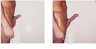 stretching exercises for penis Stretching exercises for penis