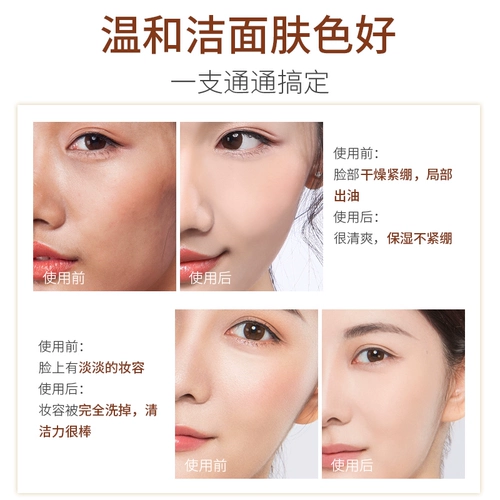 Мужское очищающее молочко на основе аминокислот, официальный продукт, глубокое очищение, сужает поры, контроль жирного блеска, анти-акне