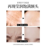 Anti -Wrinke Head Head -Up Tattoos для удаления морщин Удаление артефактов поднятие укрепляющих морщин Сычуань.