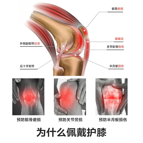 探险者 Дорожные альпинистские защитные наколенники подходит для пеших прогулок, спортивное защитное снаряжение для спортзала для велоспорта, для бега