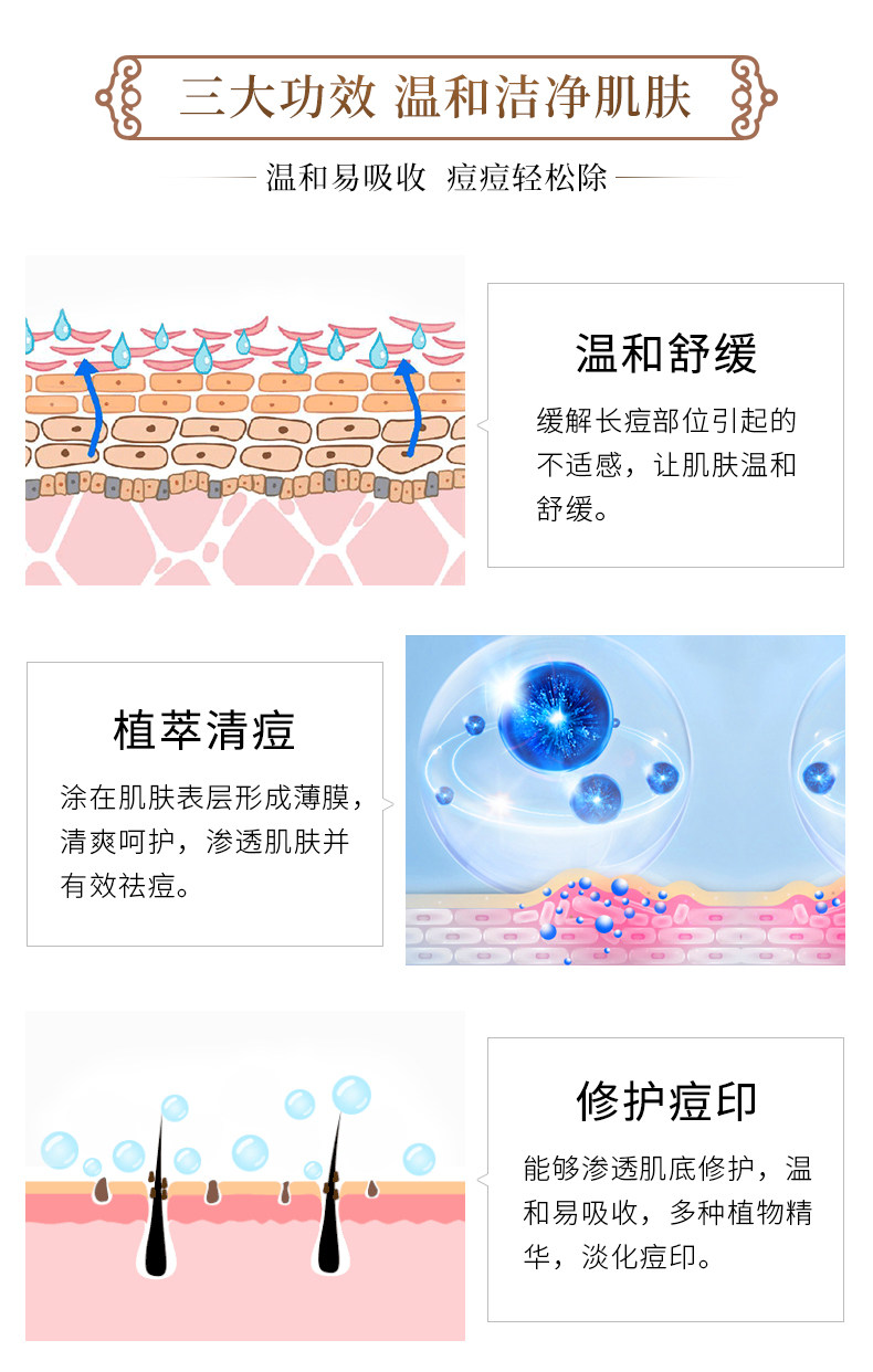 Acne Cream_03.jpg