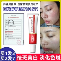 Fanyan whitening and freckle removing cream to remove spots and chloasma freckles hydroquinone cream to remove melanin and fade spots