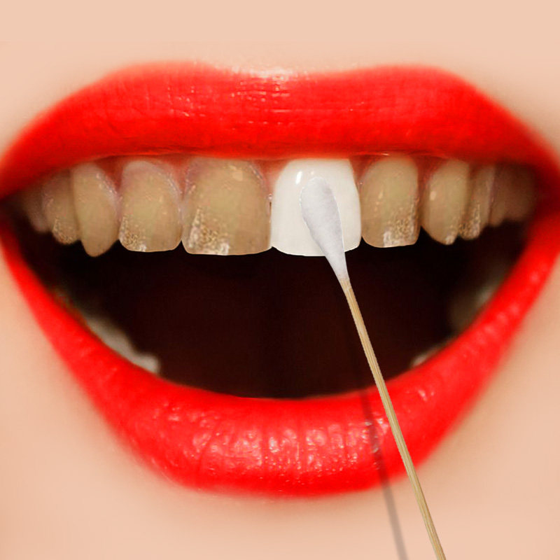 (Small Red Book Recommended) teeth change white to smoke stains dental plaque dental plaque tooth-cleaning powder to the yellow tooth deity