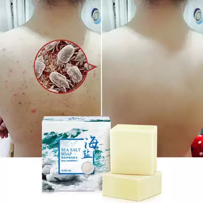 Sea salt soap mites soap facial Li Jiaqi recommends anti-mite facial deep cleaning sterilization body sulfur soap