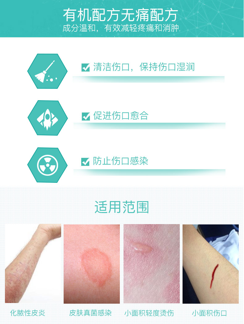 德国进口 SOS 儿童伤口清洁消毒喷雾 50ml 抑菌温和不刺痛 图3