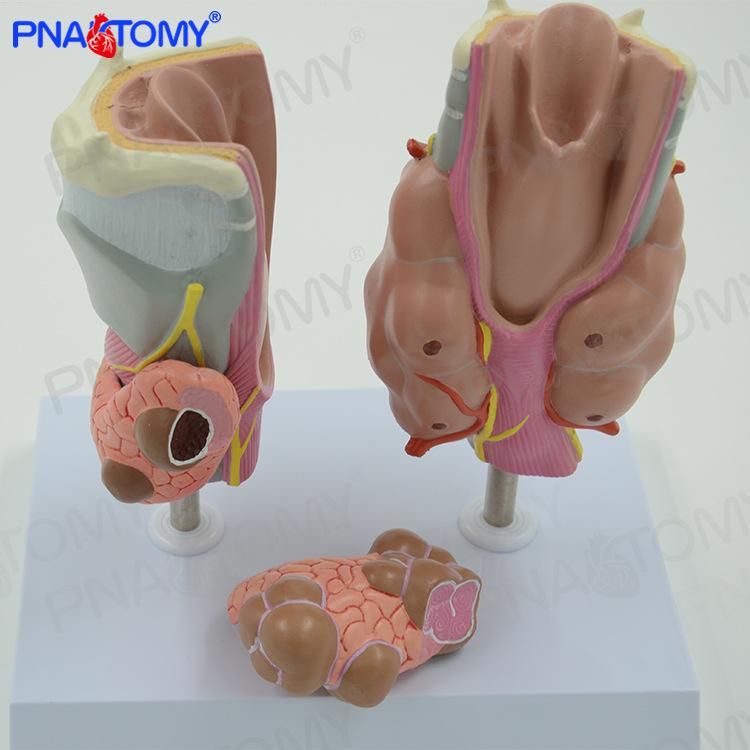甲状腺病理喉头医学解剖模型甲亢甲低甲jian内分泌系统内科标本