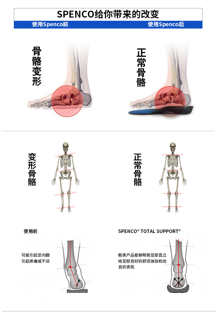 美国 Spenco 思奔客 稳定系列 足弓支撑多功能鞋垫 图3