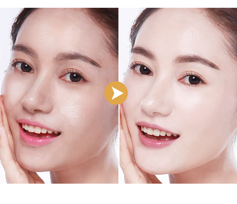 Dịch niacinamide gốc chất lỏng tinh chất mặt tinh chất nữ dưỡng ẩm kiểm soát lỗ chân lông làm sáng tông màu da tinh chất klairs