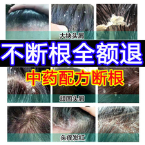 Treatment of scalp hair follicle shampoo with mite desquamation for chipping and control oil to mites and dandruff and dandruff and dandruff.