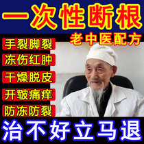 Frozen Sore Cream Cure Root Detumescence Anti-Frost Anti-Frost Damage Cream Jelly Freeze Hands Winter Pain Pain Hand Foot In The Face