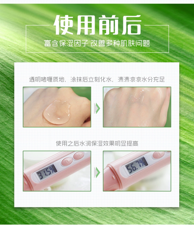 Aloe vera gel chính hãng mụn trứng cá nữ mụn trứng cá marks mụn trứng cá lotion trị mụn của nam giới sinh viên kem lotion