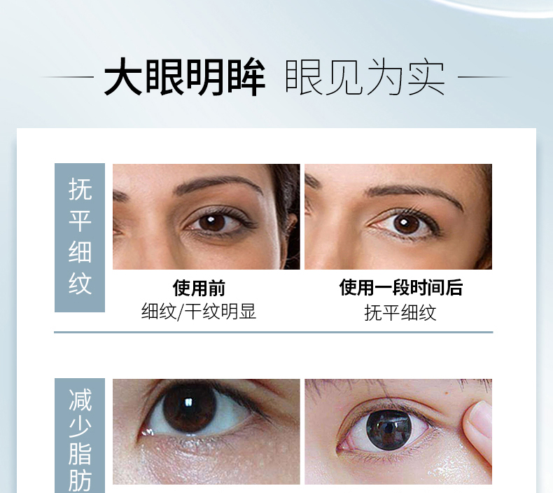 Kem dưỡng mắt Yalijie Aloe to Desalination Dark Circle Eye Bag Fine Line Moisturising Liftming Firming Eye Care kem dưỡng da mắt