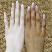 (Recommended by Watsons) Say goodbye to boiled hands turn grandma’s hands into girl’s hands massage with delicate hands