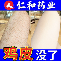 Niacinamide whitening moisturizing chicken skin pimple Hair follicle keratin body milk removal artifact Female summer man