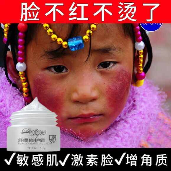 Go to red blood wire to repair the stratum corneum to improve sensitive skin thickened and remove the face pan-red thin allergy repair skin