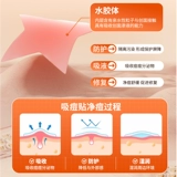 Пластырь от прыщей со звездами, медицинский ремонт, противовоспалительный пластырь, пластырь от прыщей, впитывающий гной искусственный гидроколлоид кожи, пластырь для консилера макияжа