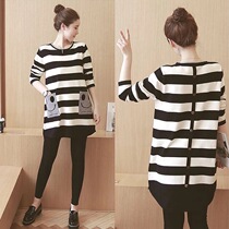 Pregnant women autumn suit fashion model 2021 New coat tide mother long spring and autumn pregnant women out two sets