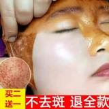 Косметическая отрывная осветляющая маска для лица, для салонов красоты, удаление веснушек