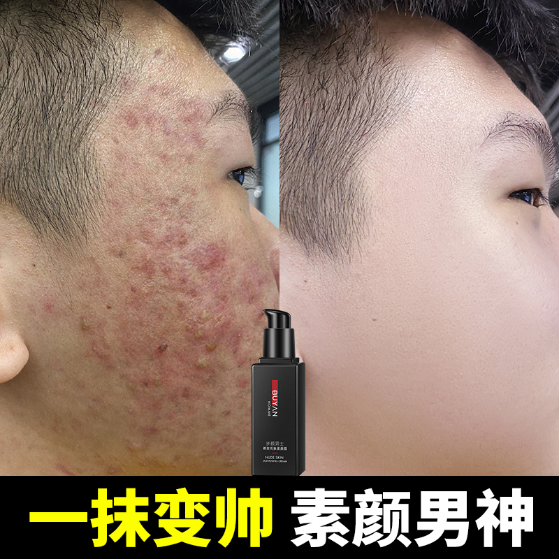 Suyan cream men's special lazy bb cream concealer face acne printing liquid foundation cosmetics set full set of natural colors