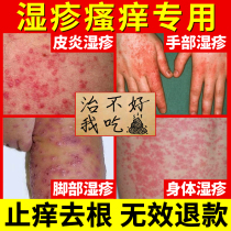 Eczema itching to shi du qing skin to itch scrotum asshole itch root privates itching antibacterial herbs itch cream