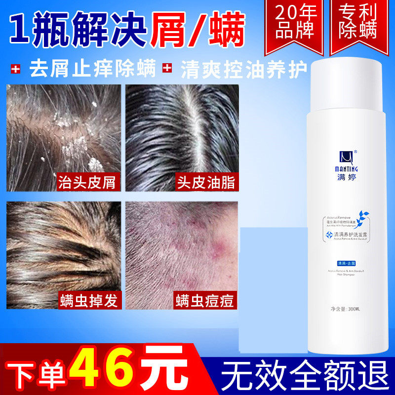 Full Tingling de-mite shampoo Anti-dandruff Dandruff Shampoo Hair Dew Control oil Go to mites to nourish and nourish the essence 