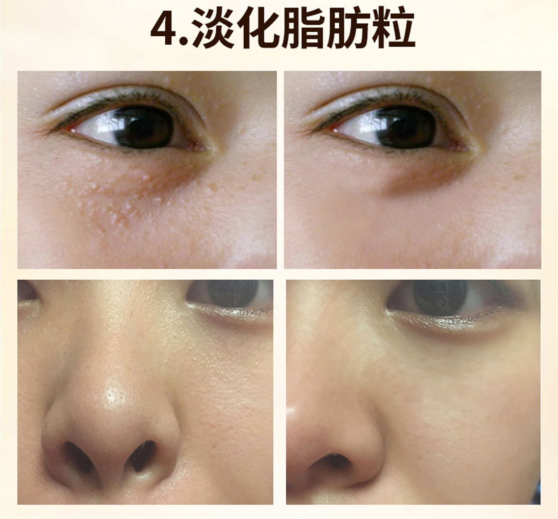 2018 Snake Eye Cream to Dark Circles Lightening Kháng Fine Wrinkle So nhẹ Eye Care Cream Eye Mask Eye 30g cây lăn mắt
